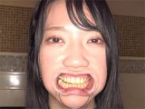 【歯フェチ】「清楚美女 葉月英里チャンの超・超・超貴重な口内・銀歯・のどちんこ観察！」葉月英里